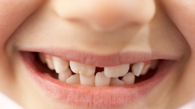 Orthodontie de l’Enfant : l’essentiel 