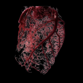 Intervention artistique